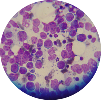 Canine Lymphoma